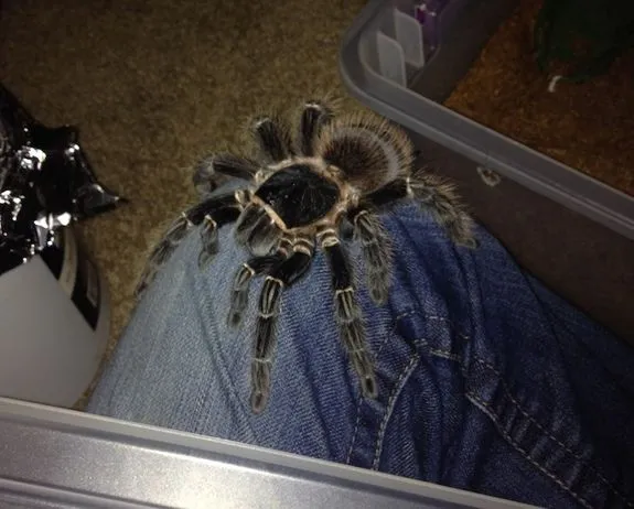 15365 allergic reaction