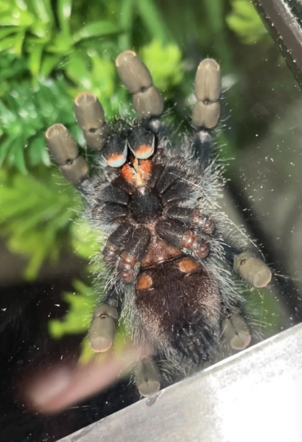 15375 tarantula epigastric furrow